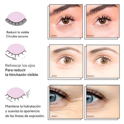 Mascarilla para Ojos Hinchados y Ojeras